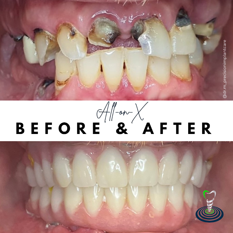 Precision Implant Care, New York City