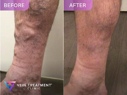Vein Treatment Clinic, New York City